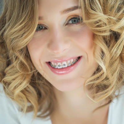 A young woman with a radiant smile, showcasing her straight teeth and braces, poses for a portrait.