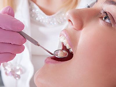 A dental professional performing a procedure on a patient s teeth, with the patient s mouth open and the professional using tools.